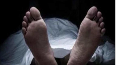Dead body