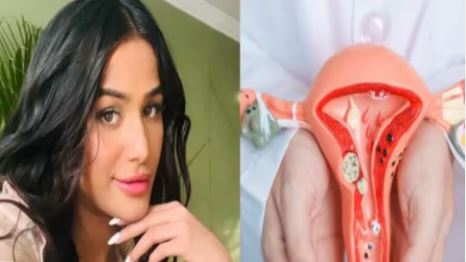 The demise of actor-model Poonam Pandey, due to cervical cancer a day after the government's push in the Budget to vaccinate girls in the 9-14 age group, has brought attention to the disease, which exhibits a high mortality rate.