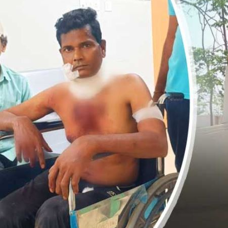 Mohapatra was found in a half- burnt condition from a crematorium near Biratgadi area of the city. He was rushed to hospital in a critical condition. However, he succumbed to his injuries after some time