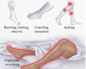 An international team of scientists has found genetic clues that can lead to new treatment for restless leg syndrome, a condition common among older adults.