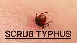 Scrub Typhus 