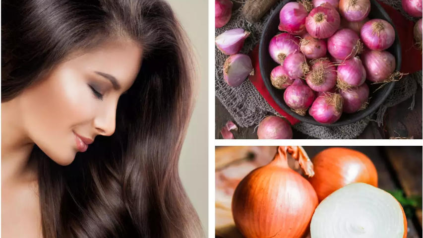 Onion juice is one of the best-known remedies essential because it has a high amount of sulphur that makes it effective in reducing hair loss. Sulphur improves collagen production which is essential for the formation of hair follicles and also cleanses the skin