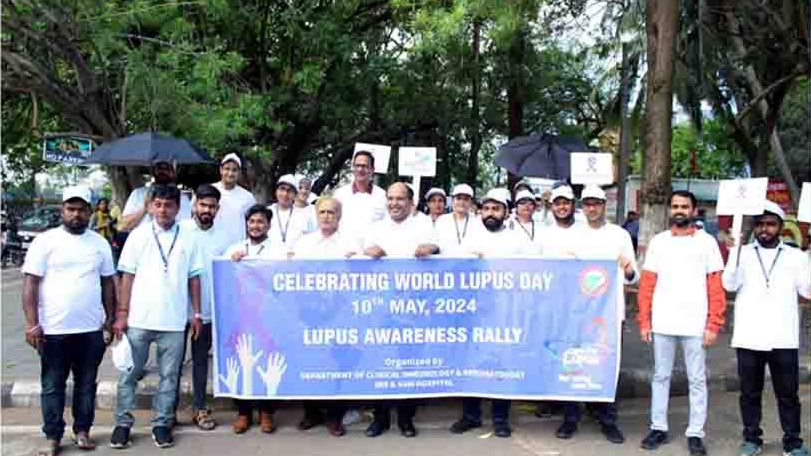 Lupus is an auto-immune disease which mimics the symptoms of many other ailments confusing both the patient and the physician. If the diagnosis is done properly and treatment provided, the patient can be cured, they said