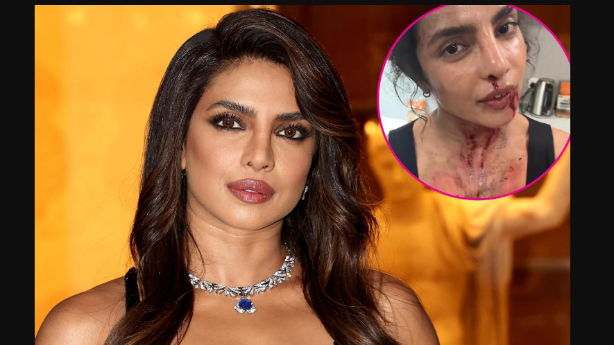 In the images, Priyanka is seen adorned with realistic makeup and prosthetics, depicting her character with blood stains and bruises. One video captures her inquiring about the technique to simulate burnt hair, with her makeup artist explaining the use of crushed breakfast cereals for the effect