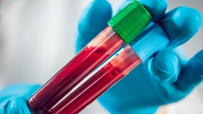 Blood proteins identified that could predict cancer