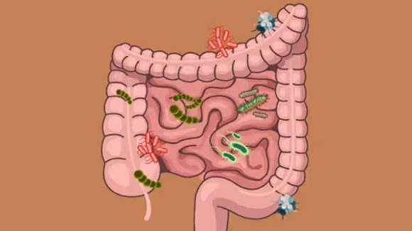 Researchers identify gut bacteria responsible for compulsive eating, obesity